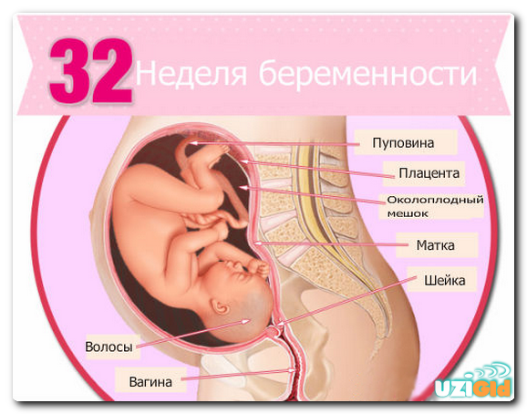 узи на 32 недели беременности