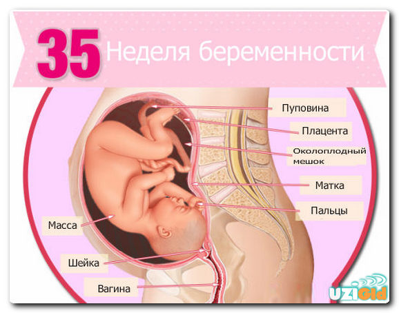 узи 35 недель беременности узи